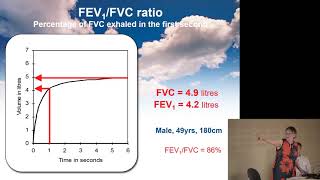 Spirometry Interpretation  Prof Hilary Pinnock [upl. by Zul714]