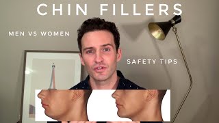 Chin fillers A guide for a proportionate lower face [upl. by Atiuqnahs]