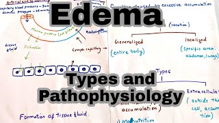 EdemaOedema  Types and its Pathophysiology [upl. by Gnouhc]