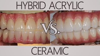 Whats the difference between acrylic and ceramic  Patients Ask [upl. by Snah]