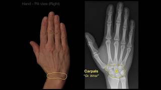 Anatomy of Hand XraysRevised [upl. by Reiter]