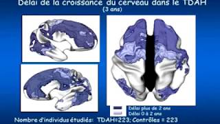 9 Exercices Pour le Cerveau Qui Renforceront Ton Intelligence [upl. by Ehrsam988]