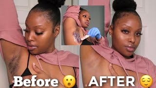 WAX Your Underarms AT HOME  How To Lighten Dark Underarms Naturally Detailed [upl. by Lartnom]