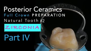 Zirconia Ceramics Part 4 AllCeramic Crown Preparation 2 Natural Tooth [upl. by Ettennal431]