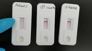 Immunology Infectious Mononucleosis Test [upl. by Hera236]