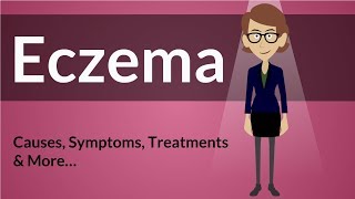 Eczema  Causes Symptoms Treatments amp More… [upl. by Hogarth]