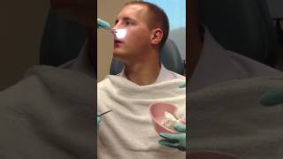 My Deviated Septum Surgery  1 Week Update [upl. by Delmor]