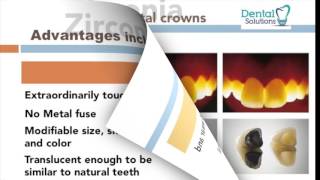 Zirconia crowns vs Porcelain Metal Crowns PMC [upl. by Notfilc]