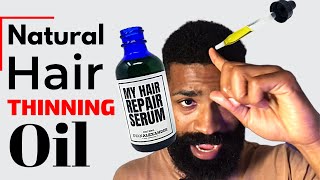 How To Apply MY Hair Repair Serum  Regrow Hairline [upl. by Ettennad]