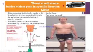 Transtibial gait deviation [upl. by Yart]