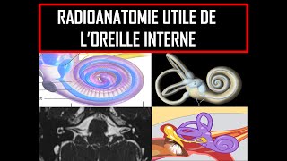 Radioanatomie utile de loreille interne [upl. by Aleras880]