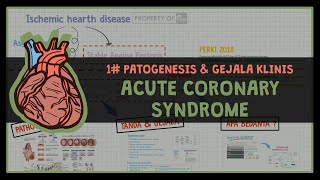 PENYAKIT JANTUNG KORONER  INI PENJELASAN PENYAKIT SINDROM KORONER AKUT 1 ACUTE CORONARY SYNDROME [upl. by Hnaht]