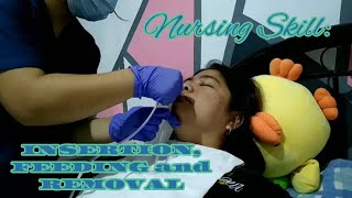 NASOGASTRIC TUBE PROCEDURE Insertion Feeding amp Removal  Return Demonstration [upl. by Reviere]