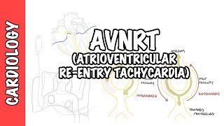 Reentry mechanism of tachyarrhythmias [upl. by Rowan984]