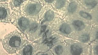 16 Identification of phases of mitosis in cells viewed with a microscope [upl. by Ynwat759]