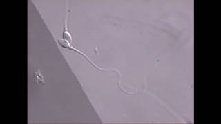 Sperm swimming in microscope field [upl. by Fredek482]