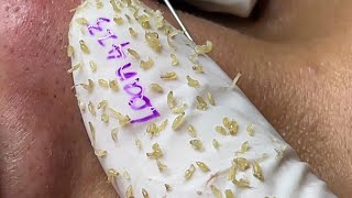 Satisfying With Loan Nguyen Spa Video 013 [upl. by Ramberg962]