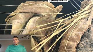 Brachial Plexus EXPLAINED Using a Cadaver [upl. by Leonard353]