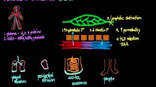 Disorders of Circulation Edema [upl. by Ailema208]