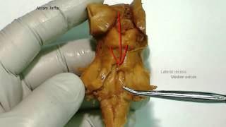 Pons external anatomy [upl. by Swor]