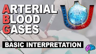 Basic ABG Interpretation  Arterial Blood Gases Part 3 [upl. by Im]