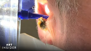 Water Device Painlessly Removes Earwax  Art Insider [upl. by Atsirc]