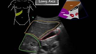 POCUS  Gallbladder Ultrasound Anatomy [upl. by Chandal]