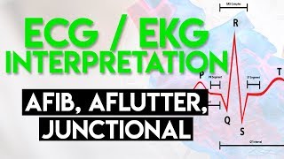 Afib Aflutter Junctional Arrhythmias  ECG EKG Interpretation Part 4 [upl. by Gschu]