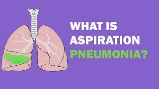 What is Pneumonia Medical Definition [upl. by Leinadnhoj376]