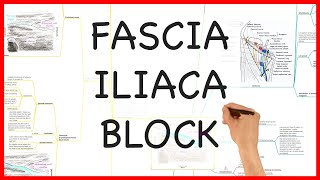 FASCIA ILIACA BLOCK PRACTICAL CONDUCT SERIES [upl. by Allehcim]