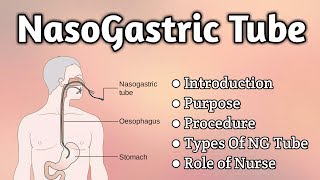 Nasogastric Tube Intubation [upl. by Ahseek]