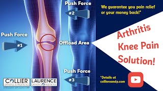 MAKOplasty RoboticAssisted Surgery for Partial Knee Replacement [upl. by Corvese]