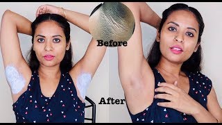 Live Result In Just 10 minutes Dark Underarm Whitening 100 Works [upl. by Ybok849]