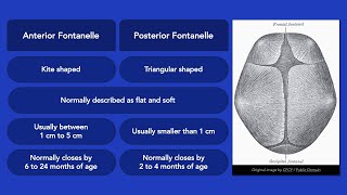 Fontanelles [upl. by Sundin]