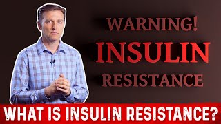 What Is Insulin Resistance – Dr Berg [upl. by Diad]