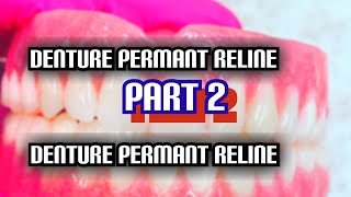 Denture Permanent Lab Reline 2 [upl. by Drageruaeb]