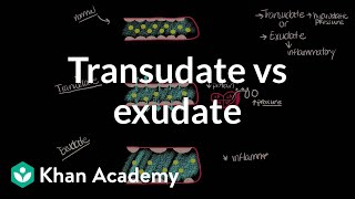 Transudate vs exudate  Respiratory system diseases  NCLEXRN  Khan Academy [upl. by Bud]