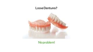 Denture Reline Kit  Perma Laboaratories [upl. by Ykcub]