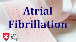 Atrial Fibrillation ECG  EMTprepcom [upl. by Ellenig]