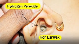 How to Use Hydrogen Peroxide To Remove Earwax [upl. by Anohs]