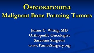 Chordoma  aggressively growing tumor in CT and MRI sequence english [upl. by Dnalro]