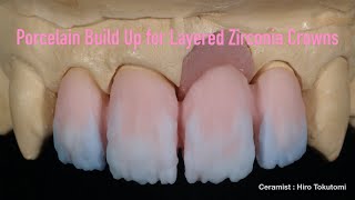 Porcelain Build Up for Layered Zirconia Crowns [upl. by Sirdna221]