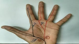 Median Nerve  3  Branches in Hand APB FPB OP Lumbricals 1 and 2 [upl. by Nathaniel985]