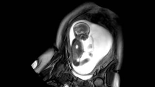 Foetal Development Unborn Baby Movement at 24 Weeks  WIRED [upl. by Adieren]