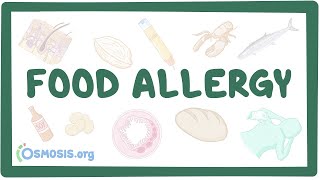 Managing Food Allergies in the School Setting [upl. by Ejrog846]