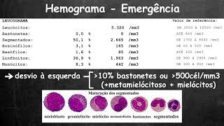 Avaliação rápida do hemograma [upl. by Australia]