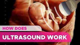 How Does an Ultrasound Works [upl. by Sillert]