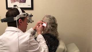 Micro Suction Cerumen Ear Wax Removal Procedure [upl. by Pember]