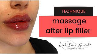 Lip Filler Massage and how to fix Bumps [upl. by Shari]