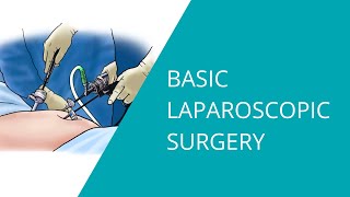 Basic Laparoscopic Surgery [upl. by Hachman]